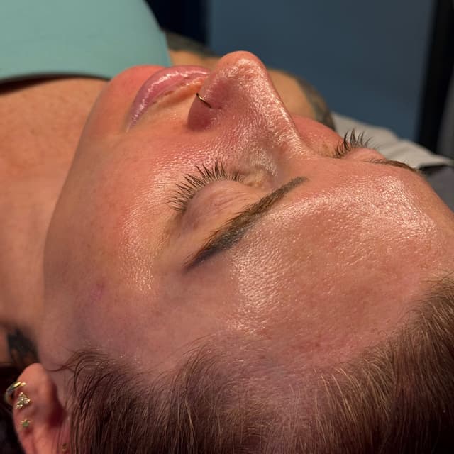 Texture Reset Package at Services By Kelsey | Esthetician in Beavercreek, OH